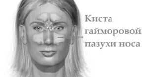 причини