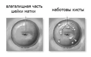 лікування