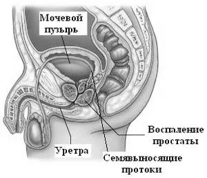 простати