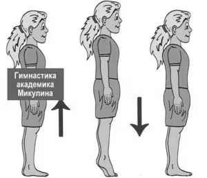 варикоз