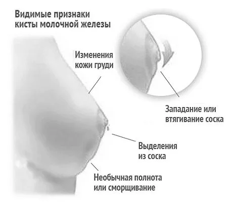 таке