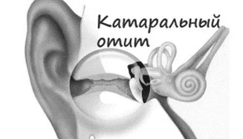 катаральний