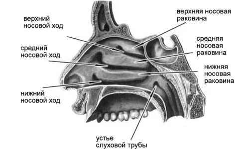 риніт