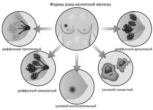 причини