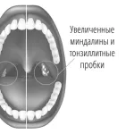 лікувати