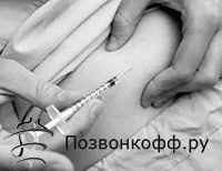 уколами