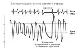 лікування