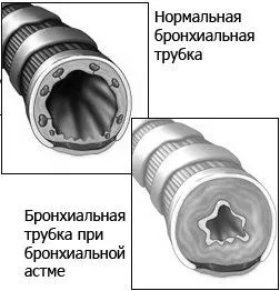 допомогою