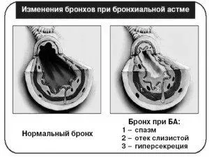 лікування