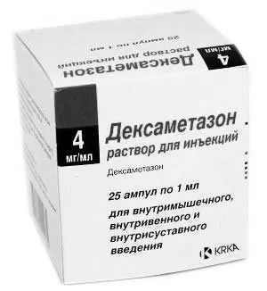 радикуліту