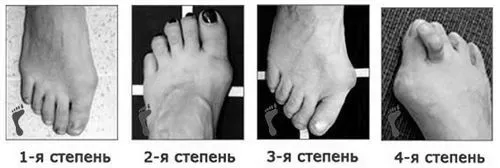 рецепти
