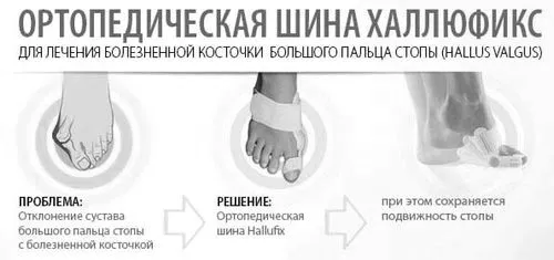 лазер