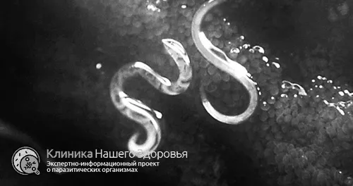 умовах