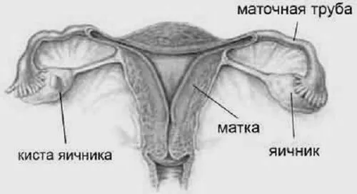 лікування