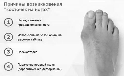 лікування
