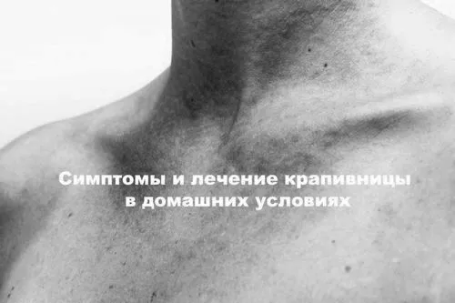 лікувати