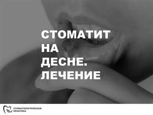 лікування