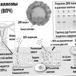як вивести дрібні папіломи
