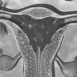 місячних