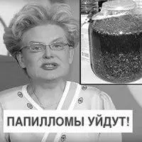 як лікувати кандидоз у дівчат