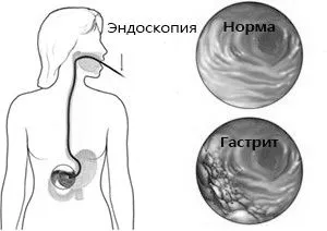 молоко