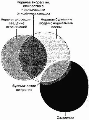 Нервова булімія що таке нервова булімія