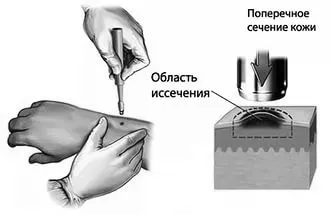 лікується
