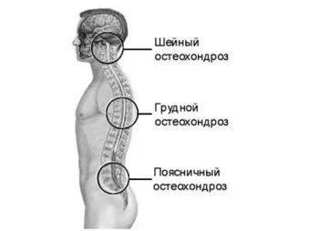 умовах