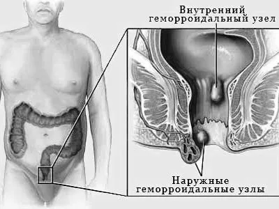 внутрішнього