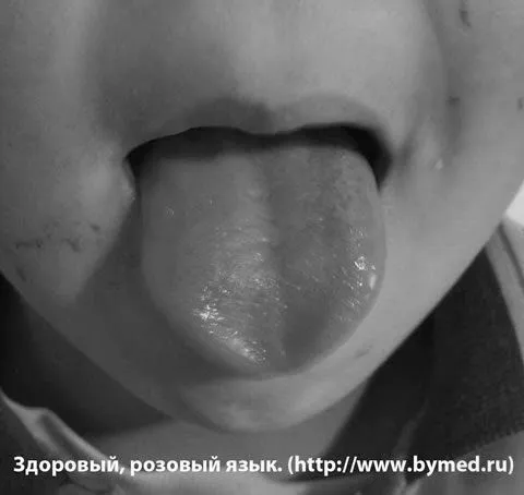 Наліт на язику остеохондроз