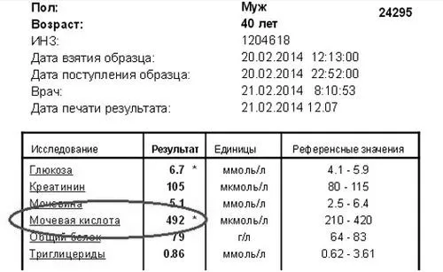 Сечокислий діатез у дорослих: симптоми і лікування сечокислий