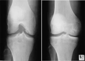лікування