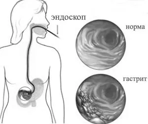лікування
