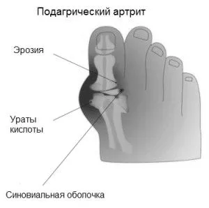 гомілковостопний