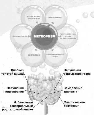 причини здуття кишечника