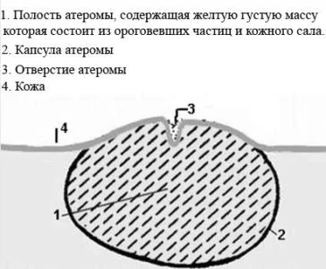 шишка