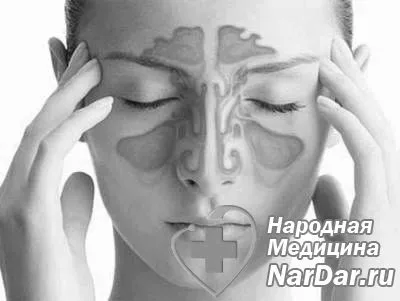 Гострий фронтит - симптоми, лікування народними засобами фронтит симптоми лікування гострий