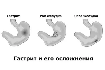 кіровцева