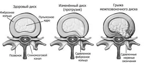 лікування