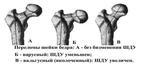стегна