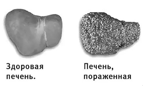наслідки
