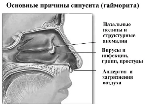 симптоми