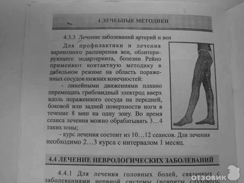 Відгук про апарат для місцевої дарсонвалізації новатор корона відгуки автовласників