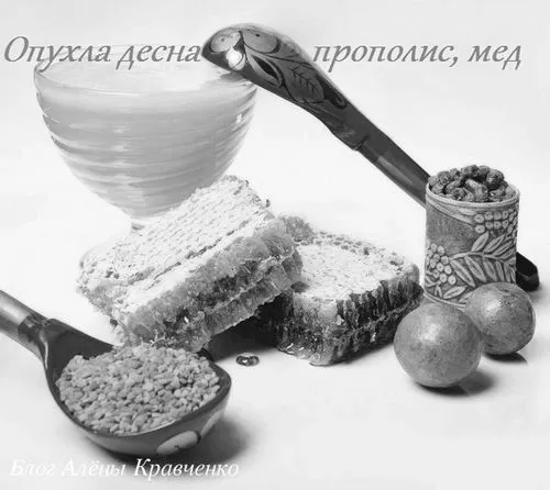 як лікувати ясна якщо вони опухли