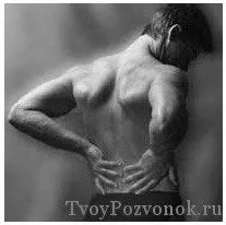 Радикуліт і остеохондроз: в чому різниця? чому