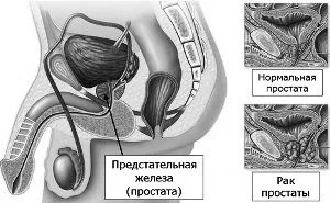 лікування