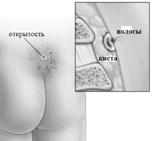 явилася
