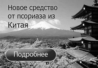 псоріаз