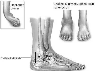 стопи