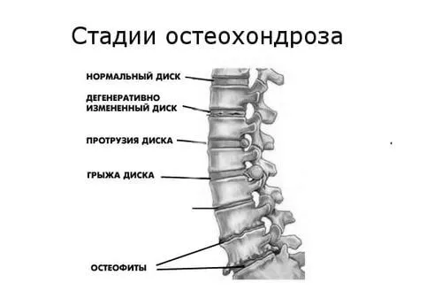лікування